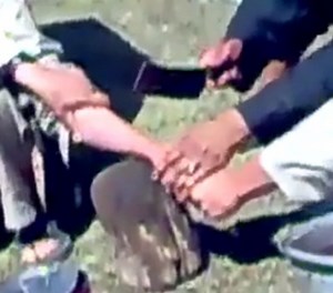 Thief Gets His Hand Cut Off As Punishment