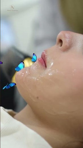 Laser Hair Removal – Permanent Solution to Unwanted Hair
