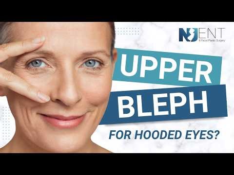 Should I Get a Blepharoplasty for Hooded Eyes