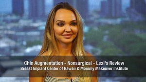 Non-Surgical Chin Augmentation to Remove Double Chin (Patient Experience)