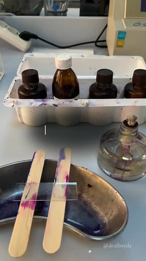 Here's the Gram staining procedure broken down point-wise for quick and easy digestion: 1. Prepare a smear Place a drop of water on a clean glass slide. Add a small amount of the bacterial culture and spread it into a thin film. Let it air dry completely. 2. Heat-fix the smear Pass the dried slide quickly through a flame 2–3 times. This kills the bacteria and helps them stick to the slide. 3. Apply crystal violet (primary stain) Flood the slide with crystal violet stain. Let it sit for about 1 m