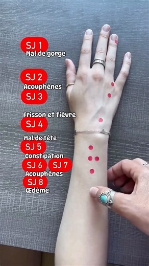Clara: Acupuncture et Médecine Chinoise on Instagram: "Le méridien du San Jiao / Triple réchauffeur (TR) ou 3 Foyers (TF) est fantastique pour éliminer l’Humidité et la Chaleur, en particulier ! * TR 1 expulse les agents pathogènes en cas de fièvre élevée, de mal de gorge et d’yeux rouges. * Les points d’acupuncture TR 2 & TR 3 sont utilisés en cas d’acouphènes, d’yeux rouges et gonflés, et de céphalées temporales. * TR 4 est le point Source Yuan du San Jiao, utilisé en cas de syndrome de Shao Y