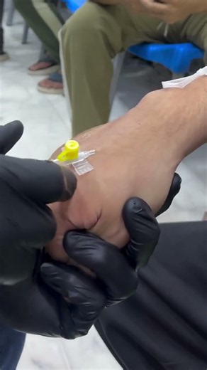 IV Injection Explained — What You Need to Know! 👀