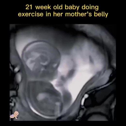 Baby 21 weeks in the womb🥰 #shorts #baby #newborn #first #trending #viral #reels | Baby stories