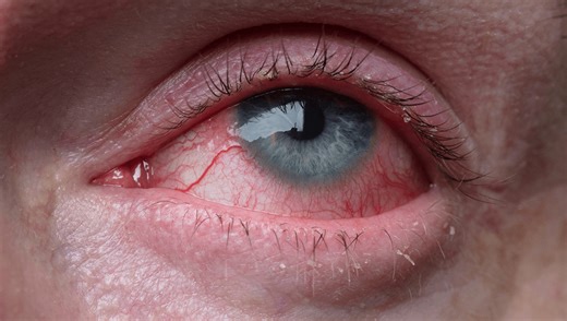 In 1963 Randy Gardner Flipped A Coin And Became The Most Sleep-Deprived Person In History