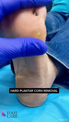 The Foot Care on TikTok