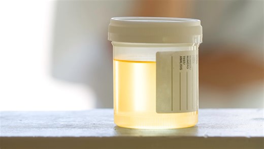 NJ medical lab fined $3.3 million over bad drug tests, Medicaid fraud