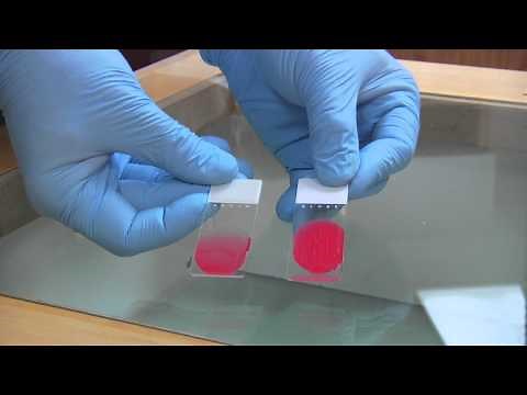 Aspirated Material Slide Techniques