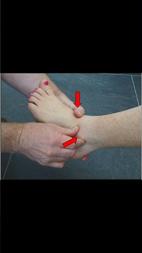 Fibular Translation Test | Assessing High Ankle Sprain #anklepain #podiatry #meded #ATC #physio