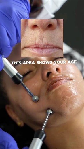 Zemits Aesthetic Equipment on Instagram: "Yes — the area around the mouth can reveal your age faster than you think. Fine lines, loss of firmness, and skin creasing here are often the first signs clients notice. The good news? There is an effective way to work with this zone — microcurrent is a true must-have. Microcurrent works by delivering low-level electrical impulses that mimic the body’s natural bioelectric signals. This helps activate facial muscles and support skin function on a cellular