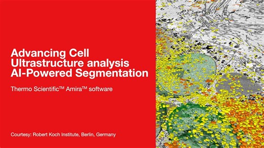 利用 Amira 软件中的AI分割技术推进细胞超微结构分析