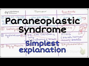 Paraneoplastic Syndrome pathology #Pathology #neoplasia
