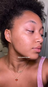 "I finally got tired of my dark spots so I tried the 14 day Skin Success Challenge! I used their dark spot corrector and the anti-dark spot fade cream for 2 weeks! You can already see a visible difference in the brightness of my skin and the lightening of my post-acne marks. You best believe I’m gonna keep using this routine! 🫧🧖🏽‍♀️" Life w Sarai #palmers #skinsuccess#fadecream #darkspots #glowingskin #hyperpigmentation | Palmer's