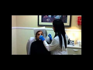 Lifting the Face with Radiesse