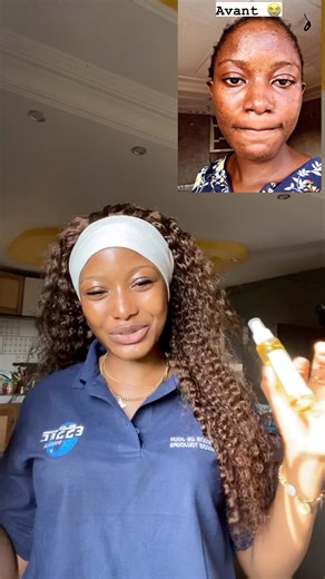 Nos produits sont 100% naturel et c’est fais pour traiter un besoins spécifiques. Nos produit ne sont pas éclaircissant n’y blanchissant c’est traitant. Nous sommes disponibles à Douala et à Yaoundé N’hésitez pas à nous faire part de vos préoccupations | PAJ cosmétique