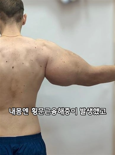횡문근융해증 회복을 위한 운동재활 #횡문근융해증 #횡문근융해증운동 #근육괴사 #근육괴사재활 #근육재활 #근육마사지 #횡문근융해증재활