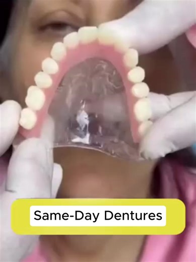14 reactions | Learn More About Same-Day Dentures: Costs | Smart Guides | Facebook