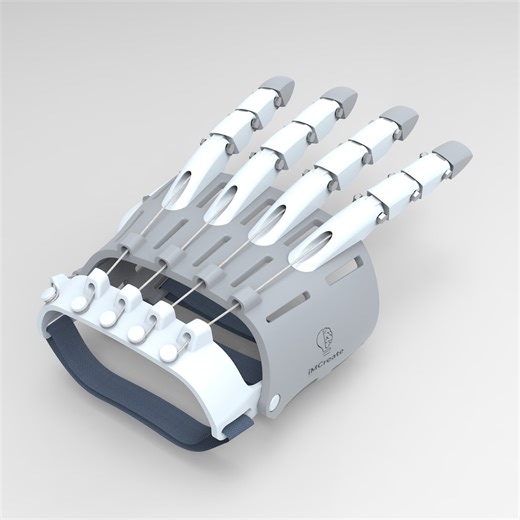 3D Print Prosthetic Hand With Elastics: STL Files (digital Download) - Etsy Hong Kong