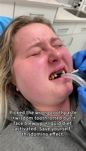 I need a good toothpaste, please help me.#Yellowteethinchildren #Help##toothpaste #KUGlG #oralcare