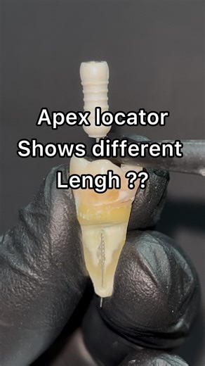 Dentistry hands on on Instagram: "❌Only the apex-locator is not enough to determine the working length. We also need a graphy too. But if you follow the following principles carefully, the length you determine with the apex locator will be very, very close to reality.💯 ✅The canal should not be too dry. Also, the pulp chamber should not be full of blood or irrigation fluids. ✅Attach the file to the special metal clamp, make sure that good electrical contact is established. ✅Place the stopper exa