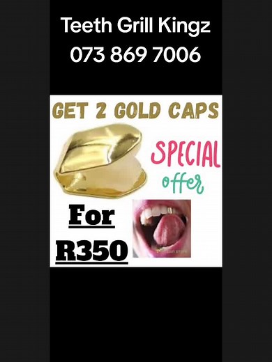 Teeth Grill Kingz on TikTok