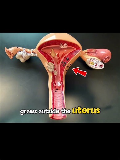 What can go wrong in the ovaries and uterus? #anatomyandphysiology
