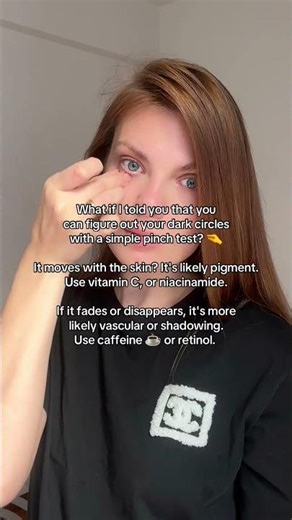 Dark Circles Test: What Your Under Eyes Are Telling You