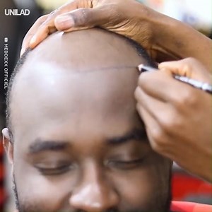 1.4M views · 1.5K shares | This bald guy looks unrecognisable after this incredible hair transformation... | UNILAD | Facebook