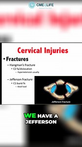 Join us as we explore the intricacies of Jefferson and Hangman's fractures. Discover the mechanisms of injury and how these conditions relate to C1 and C2 vertebrae, featuring fascinating historical references and easy-to-understand explanations. #JeffersonFracture #HangmansFracture #SpineInjury #UnderstandingInjuries #MedicalEducation #Neuroscience #CervicalVertebrae #InjuryMechanism #HealthAwareness #EmergencyMedicine | CME4LIFE | Facebook