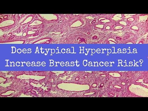 Does Atypical Hyperplasia Increase Breast Cancer Risk?