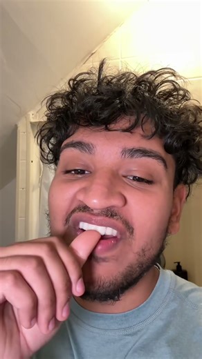 Easy White Teeth Tutorial with Whitening Strips #fok #GuruNanda