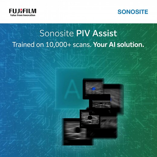 AI is only as strong as the data behind it. That’s why Sonosite’s PIV Assist was trained on over 10,000 ultrasound images—building a robust AI model designed specifically to support vascular access. What does this mean for clinicians? - Confidence in vessel identification - Real-time AI suggestions - A tool designed to assist real-world clinical practices Discover how PIV Assist supports you at the bedside: https://brnw.ch/21wXDod #PIVAssist #PIV #PIVA #USGPIV | Fujifilm Sonosite