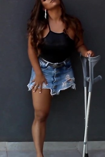 Чудеса жизни: Ампутейка и ее вдохновение