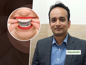 Invisible Aligners Are A Saviour For Those Struggling With Crooked Teeth, Explains Dr Singh