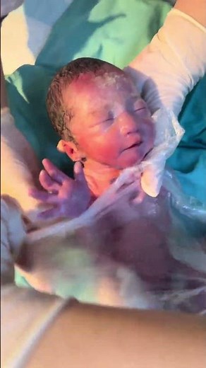 Everyone Held Their Breath Waiting for That First Cry 👶 #Newborn #firstcry