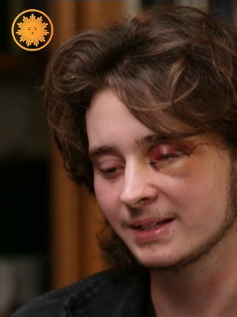 Last Friday, Kaden Rummler said he was attending a planned, peaceful protest in response to the shooting death of Renee Good in Minnesota when it turned chaotic and he was eventually shot in the eye with a less-lethal round by a federal agent at close range. Now, Rummler said he is totally blind in his left and eye and will never see out of it again. Still, Rummler said he doesn’t regret attending the demonstration: “I won't sit back when there's injustice going on.” In a statement, the Departme