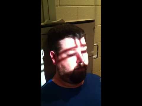 Modified Towne for Zygoma