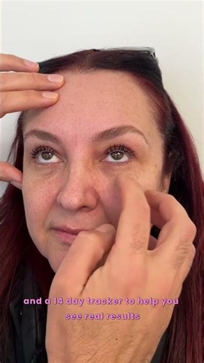 Fix Puffy Eyes Naturally – New Ebook Reveals Fast Home Remedies (Instant Results!)
