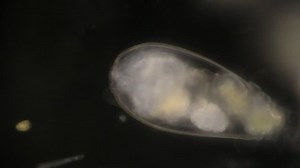 Rotifer Under Microscope Education Lab Stock Footage Video (100% Royalty-free) 1016454658 | Shutterstock