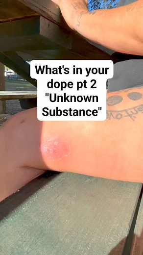 222K views · 3.6K reactions | What's in your dope pt. 2 "Unknown Substance" #addiction #recovery #foryou | Offentsive | Facebook