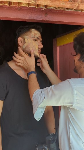 Effective Bandage Application Techniques Explained