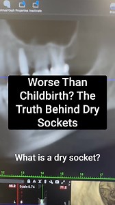 Ever heard of a dry socket? It's not just a little discomfort—it's a deep, throbbing pain that can happen after a tooth is removed… and yes, some say it's worse than childbirth 😳 Here’s why it happens—and how we prevent it naturally using something called PRF (Platelet-Rich Fibrin). Instead of leaving healing to chance, we use your own stem cells to support the healing process, reduce pain, and help your body regenerate naturally. 🌱✨ Comment "directory" to find a biological dentist near you! #
