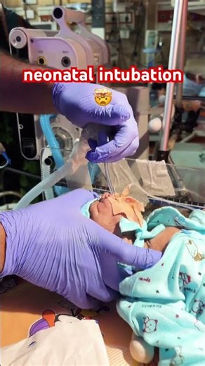 🤯intubation in neonates…#shorts #shortvideo #intubation