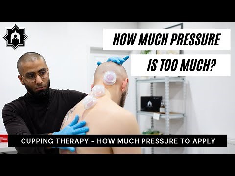 Performing Cupping Therapy (Hijama) - How much pressure is too much?