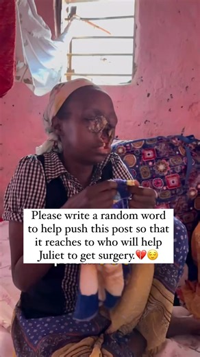 Godsgrace Uganda on Instagram: "If you have any way of helping—whether a donation, sharing her story, or simply keeping her in your thoughts and prayers—we would be deeply grateful. Every act of compassion brings us closer to the day we can bring her the medical care she deserves. Thank you for listening and for caring about Juliet’s journey. Link in bio for support 🙏"