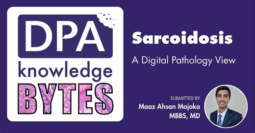 What does digital pathology reveal about sarcoidosis? This complex inflammatory disease can affect almost any organ—and digital tools are helping pathologists identify its hallmark features with greater clarity and confidence. In our latest KnowledgeByte, Maaz Ahsan Majoka, MBBS, MD, shares a concise overview of sarcoidosis, from clinical presentation to histologic patterns and the diagnostic role of digital pathology. Explore the Byte: https://zurl.co/Frg00 Have insights to share? Submit your o