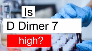 Treatment and symptoms of D Dimer 7 ug/mL | Diet for high D Dimer level 7 ug/mL