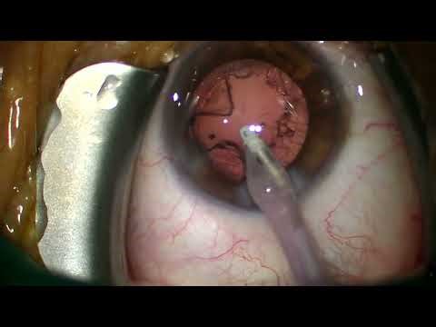 2025 11 18 162659 Panoptix pro