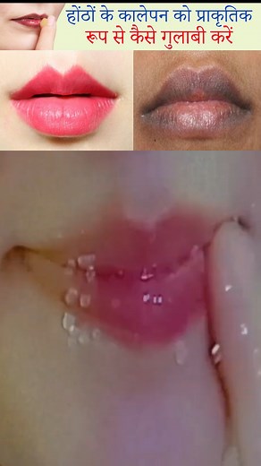20K views · 200 reactions | Amazing Hacks to dry lips to soft pink...