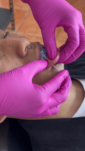 Doble Labret: ¿Podrías Aguantarlo?